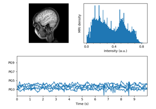 MRI with EEG